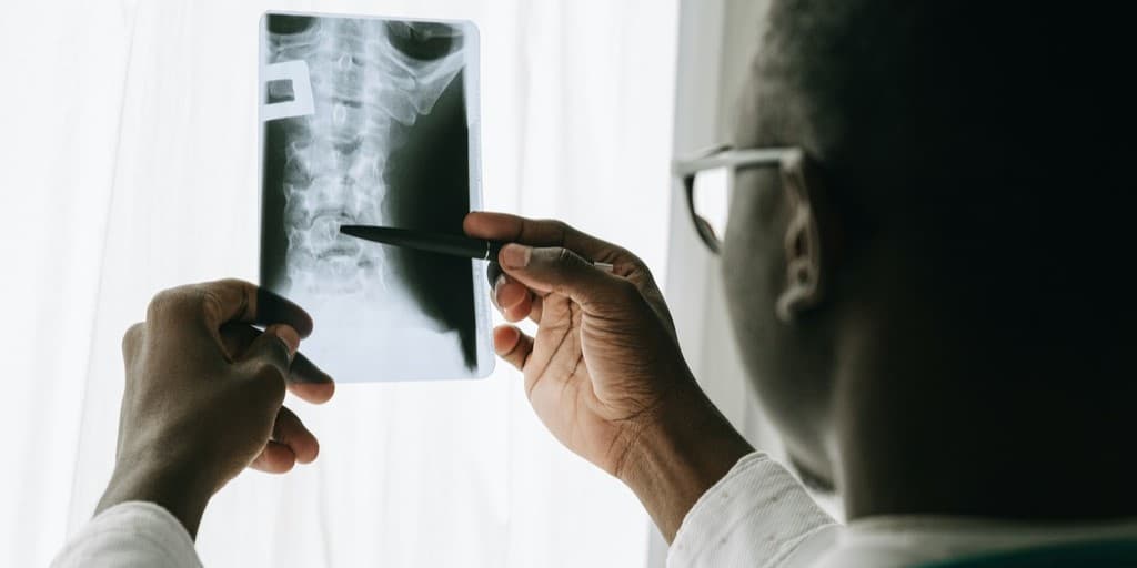 Lekarz oglądający RTG i oceniający, czy jest to kostniak