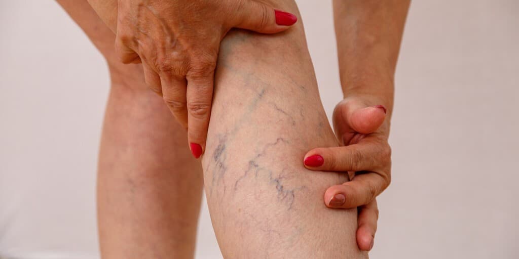 Słabe krążenie objawy