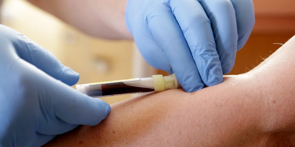 MCV i MCH podwyższone