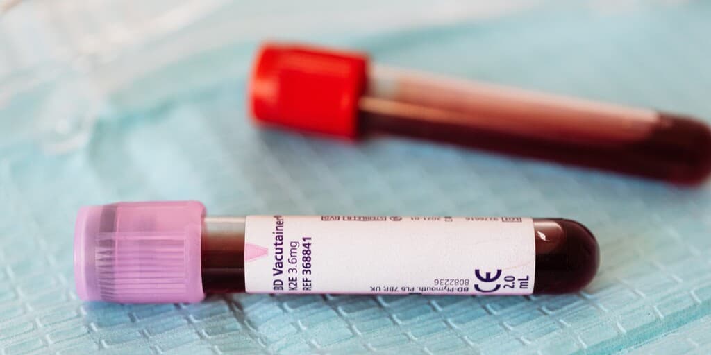 Neutropenia