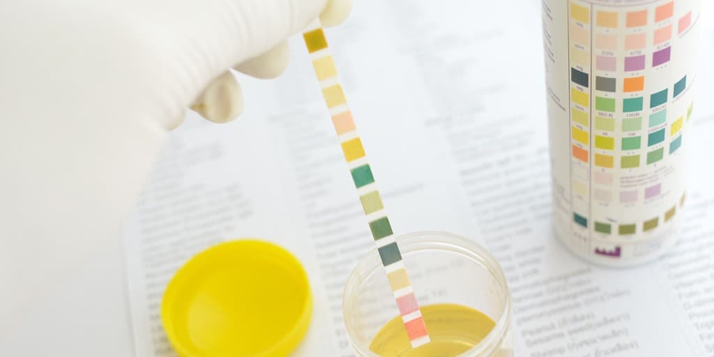 Jaki jest prawidłowy kolor moczu